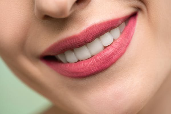 Aligner ses dents à Lille : toutes les options pour vous