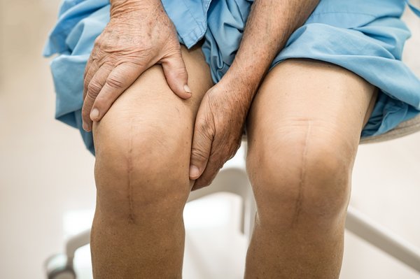 Chirurgie orthopédique à Paris : maîtrisez vos douleurs articulaires